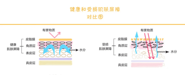 皮肤屏障(皮脂膜)组成成分:是甘油三酯,神经酰胺,脂肪酸,胆固醇,角鲨