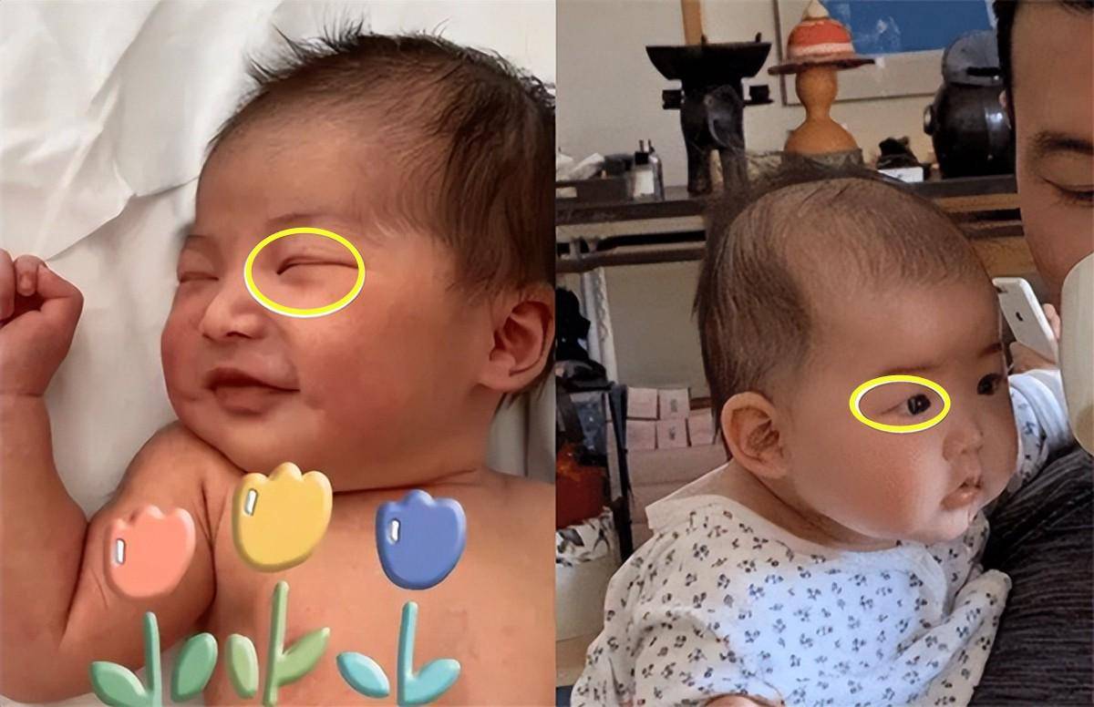 朱珠的宝宝双眼皮消失引热议,为啥宝宝的双眼皮会消失？了解一下