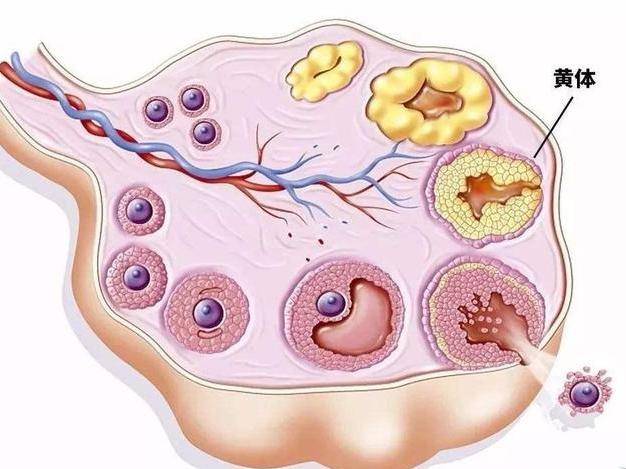 一天内3个急诊都是"黄体破裂,黄体到底是什么?_患者_治疗_盆腔