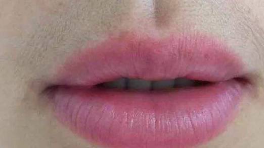 原创嘴唇处若有这7种表现可能是身体发出的疾病信号别忽视了