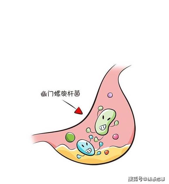 这家伙啊,是唯一能在我们胃里"强酸 消化酶"环境中长期生存的细菌,是