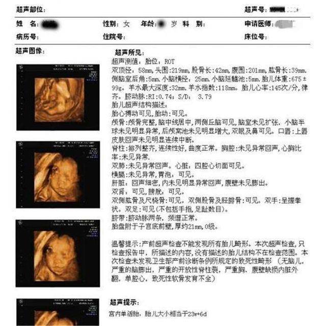 5,孕29~32周左右,进行第五次检查通常被叫做"小排畸"检查,因为某些