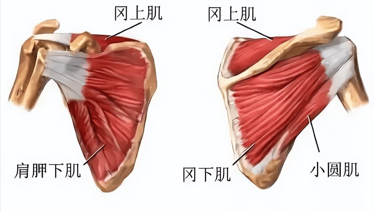 肩袖是肩关节周围肌肉的肌腱组织,例如肩胛下肌肌腱,冈上肌肌腱,冈下