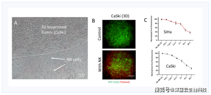 使用3d 生物打印宫颈癌肿瘤模型进行体外自然杀伤细胞检测_siha_caski