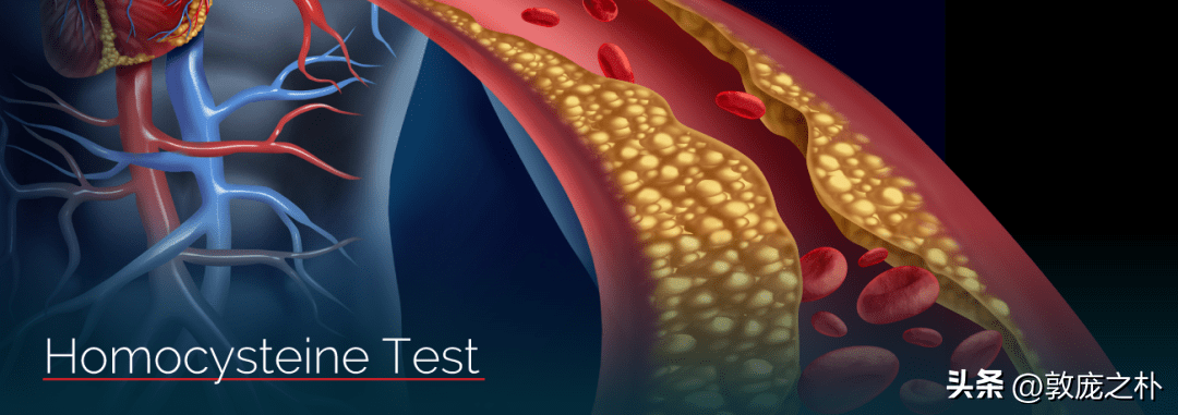 什么是同型半胱氨酸？与血液有什么关系？