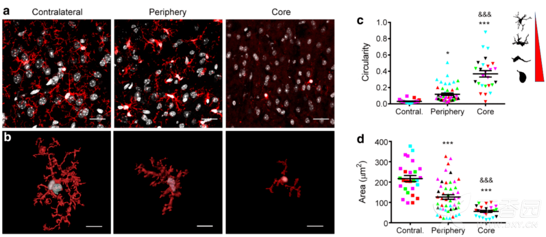 Nat Immunol | TREM2-DAP12ͨ·緢Գմеźŵ