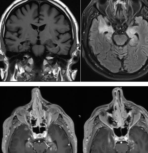 �Լ����没���͹�ע�Թ��������׶������ۺ���ح3���Ӷ�Ƭ ...