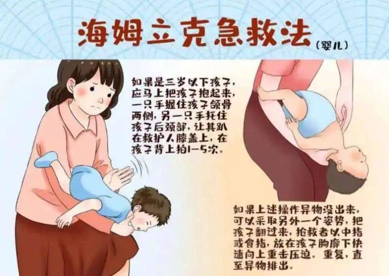 育儿小常识︱婴幼儿姆立克急救法