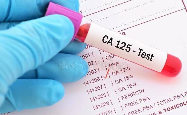 卵巢囊肿可以做哪些肿瘤标志物检查来进一步鉴别诊断？（1） ca125：ca125 用