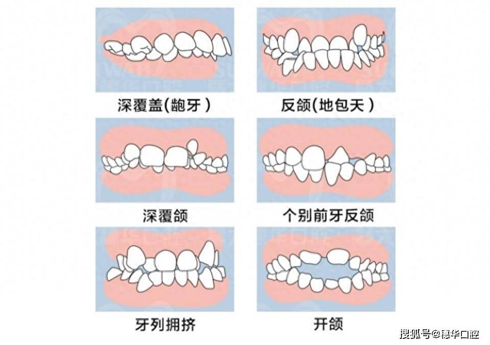 文章配图-2