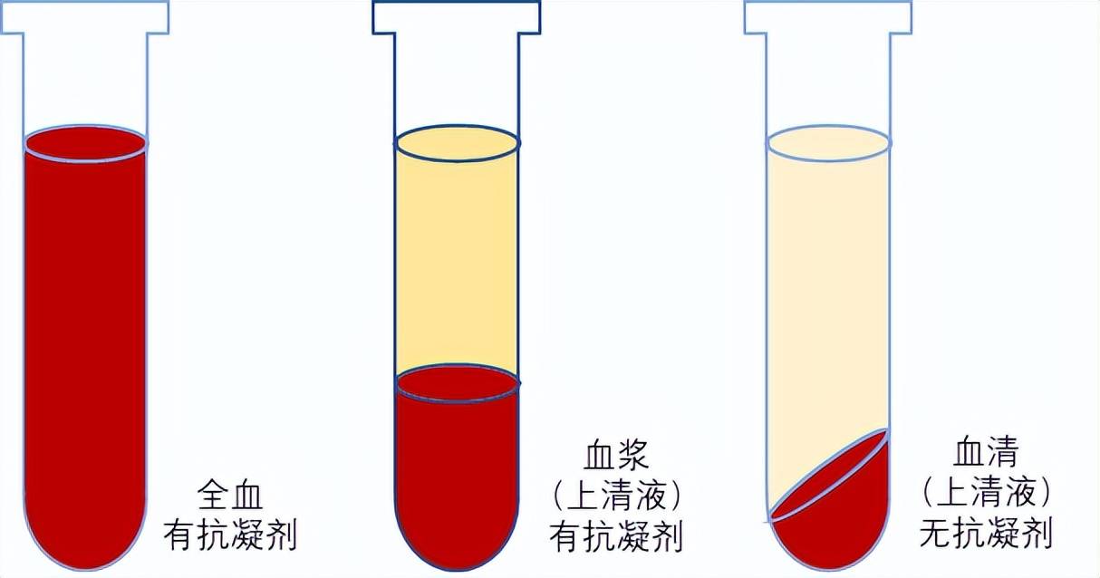 检测过程中，全血、血浆、血清哪种样本敏感性更高？