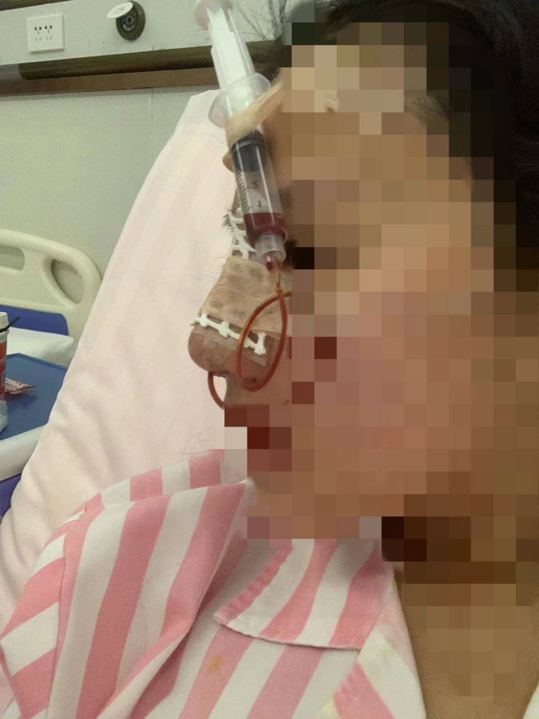 原创
            求职陷阱：四川女大学生入职当天被怂恿贷款整容，术后被迫离职