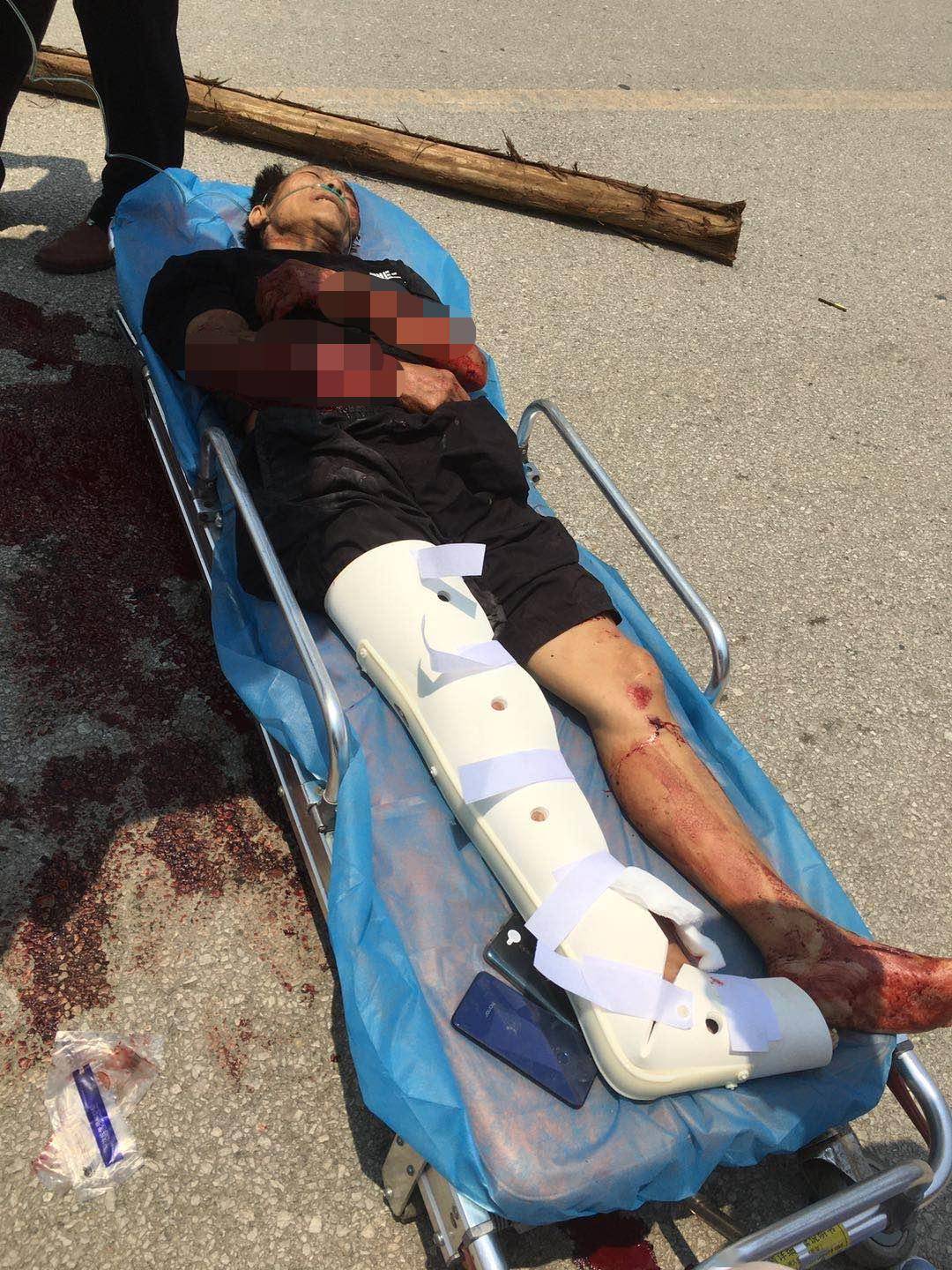 桂林突发惨烈车祸!一人卷进车底,头颈被