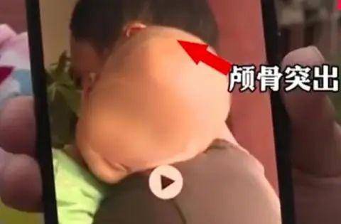 余烬热点丨余烬复起的“大头娃娃”事件何时休？