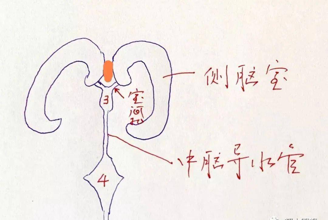 侧脑室的几张精彩解剖图