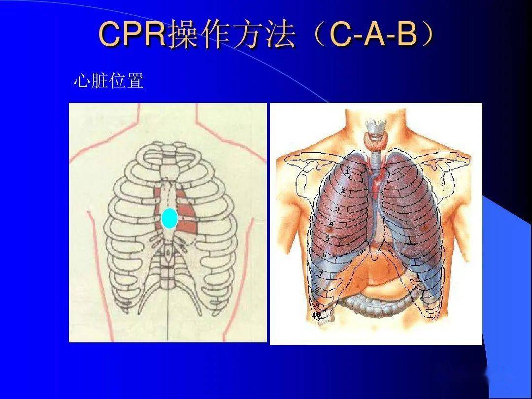 心肺复苏术-搜狐大视野-搜狐新闻