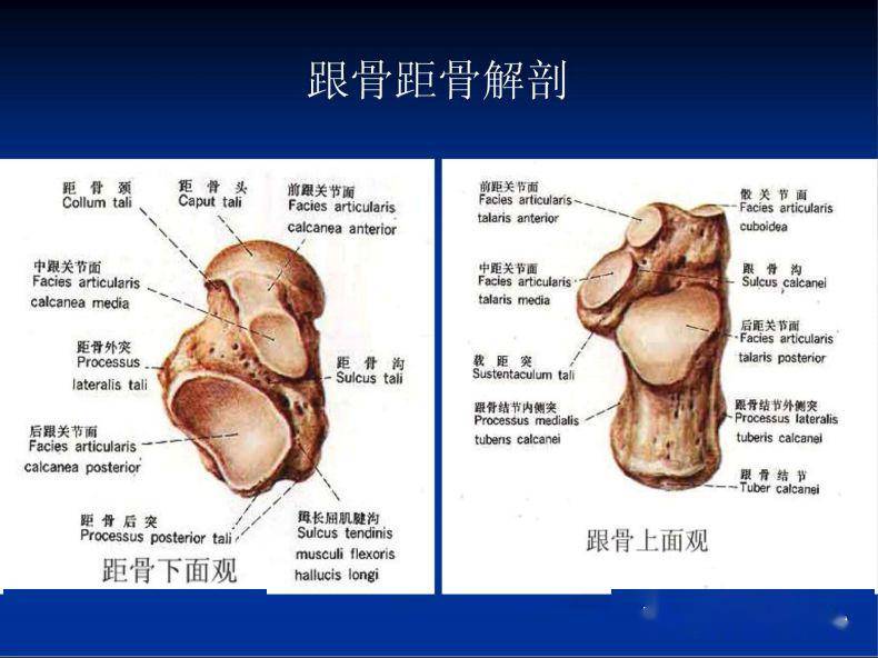 跗骨窦综合征临床与影像