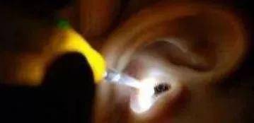 【警惕】飞虫撞进眼睛,少年这个动作导致角膜溃疡流脓