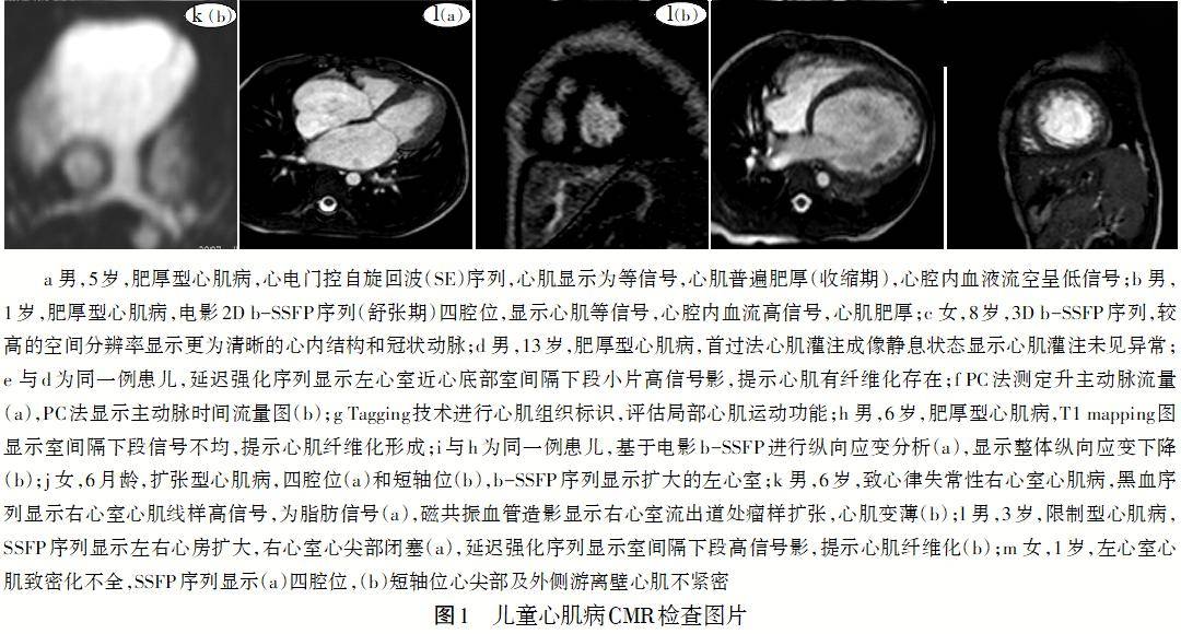 专题笔谈│儿童心肌病的磁共振检查及临床应用