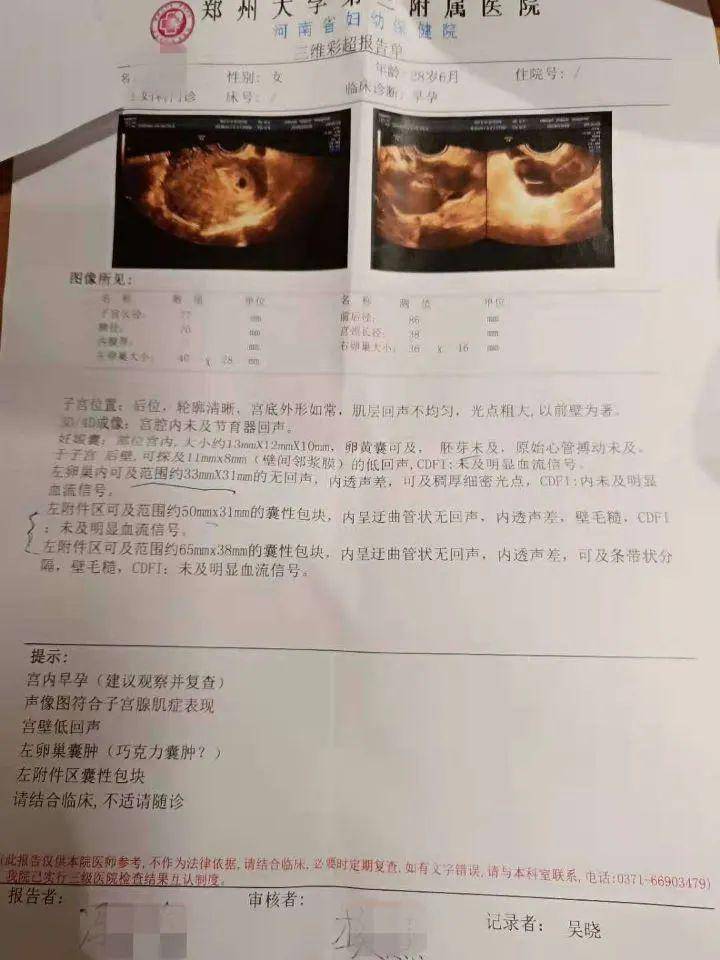 子宫腺肌症合并巨大巧囊患者受孕