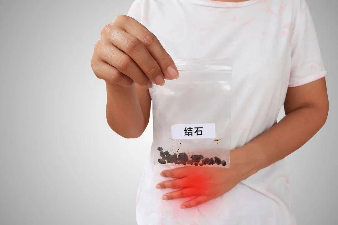 口腔结石在哪个位置 6ed217dd75fa49b6af0617b217d22e88.jpeg