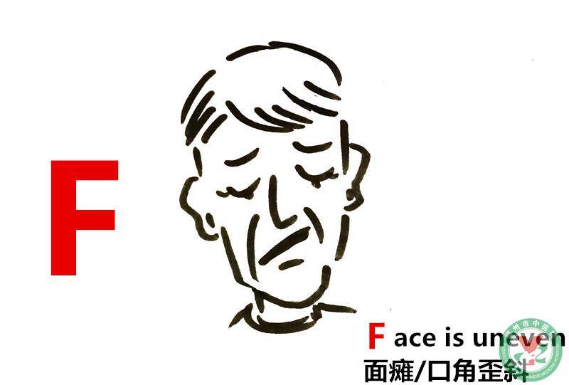 "1"看1张脸:不对称,口角歪斜