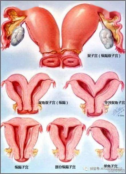 数张生殖系统医学美图,张张经典_子宫