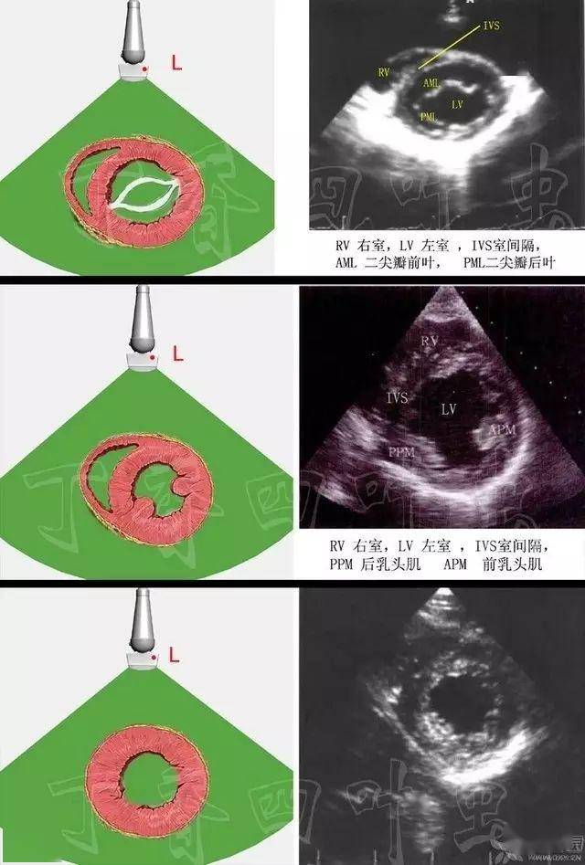 3d图解心脏解剖与心脏超声切面_左室