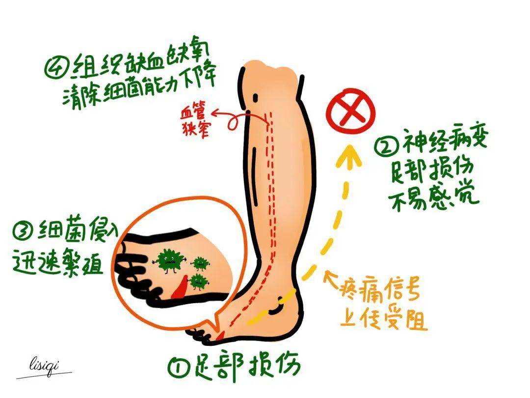 于人口足_人口普查