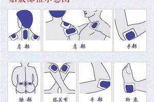 【孟字堂健康大讲堂】肩周炎贴膏药一般贴在哪个位置图