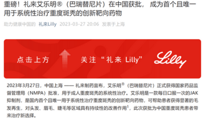 可恢复90%头发生长的斑秃新药,国内批了。你觉得好用吗?