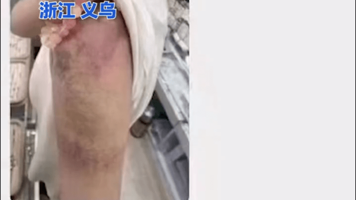 小学教师打伤学生后群内道歉,反获多名家长安慰感谢,你怎么看?