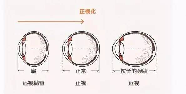 若眼轴过长,则很有可能存在近视,若眼轴过短,则很有可能存在远视.