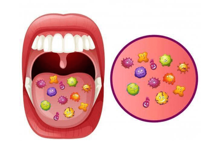 帝肤露:抗肿瘤致口腔黏膜炎及防治解析