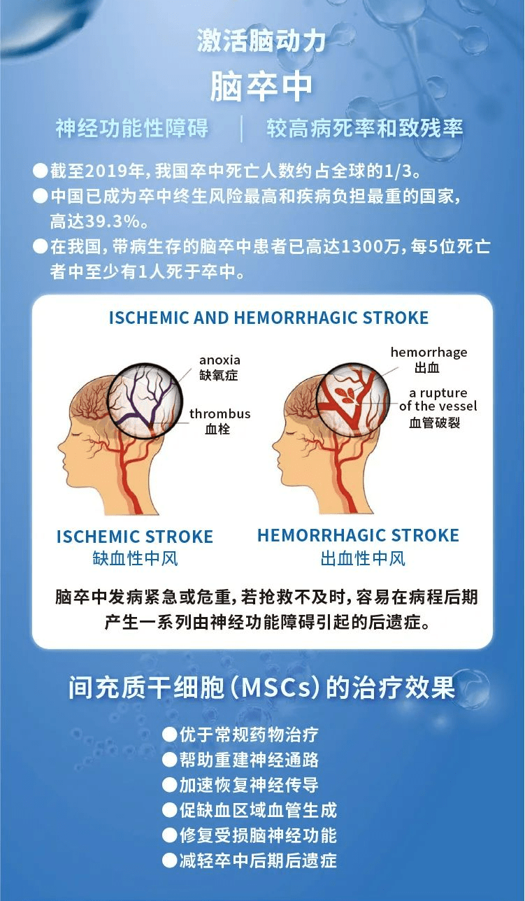 脑卒中 干细胞治疗临床实验研究