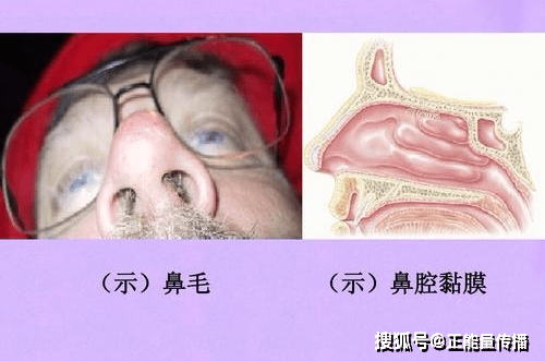 男性鼻毛丰富是一种非常正常的情况,与体内激素水平有关.