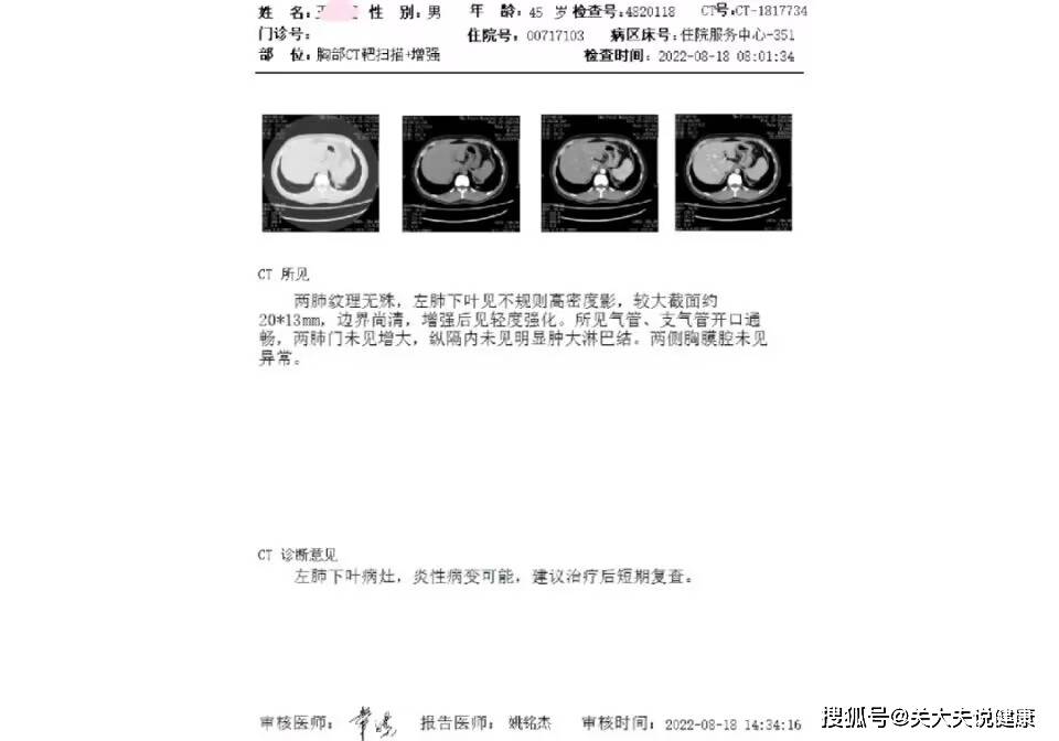 45岁的他肾结节20mm，吃了价值3.62元的药后，结节消失了