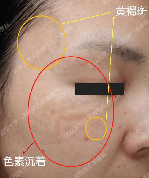 c50619d6c7334d70bb8bbbf17500f57b.png
