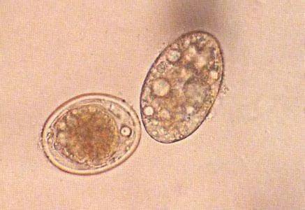 欣源|有可能感染了蛔虫等寄生虫吗？欣源说 | 孩子肚子鼓鼓的