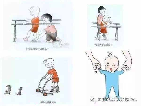 【微课堂】脑瘫儿童康复训练(各阶段)