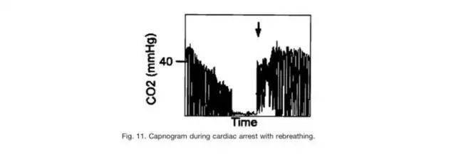 Breathing Patterns Diagram