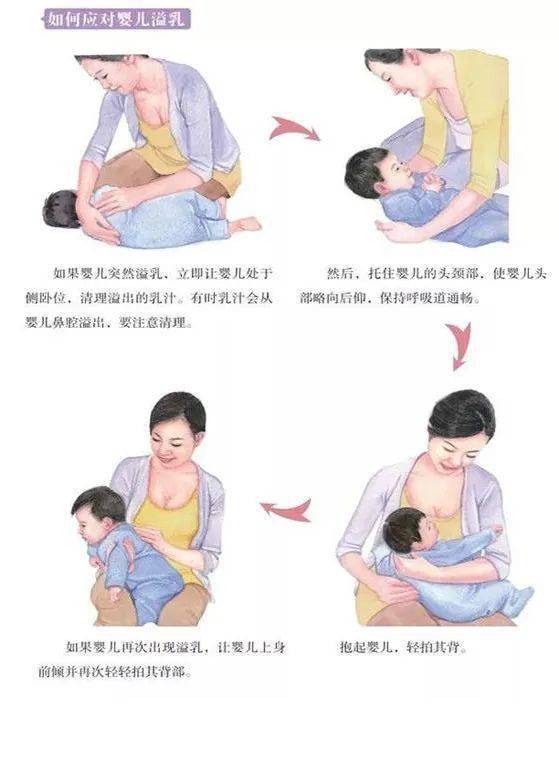 如果宝宝突然溢乳,立即让婴儿处于侧卧位,清理溢出的乳汁,有时乳汁会
