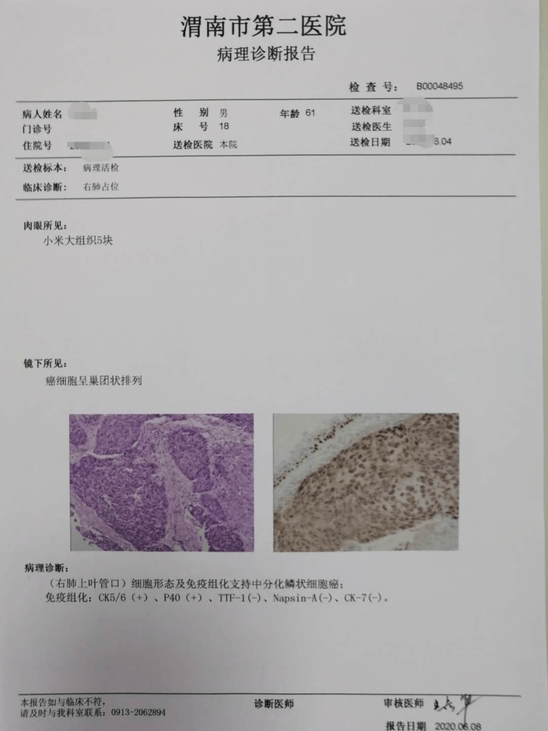 渭南市第二医院病理科成功开展免疫组化染色与诊断技术