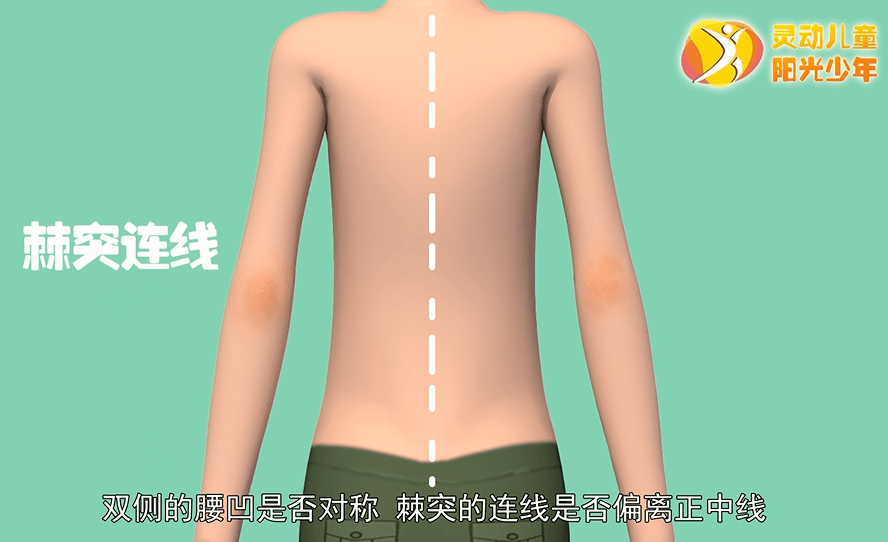 怎么看是不是正肩 3bbe46b3bdb94c27bf78c9e21fa38101.png
