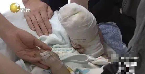 大人|大人涂了这东西!差点害得娃被截肢...孩子被开水烫伤后