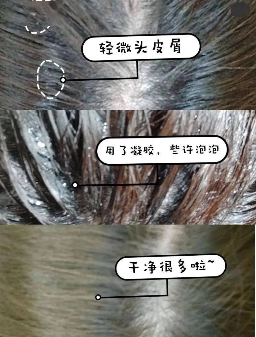 李佳琦推荐的脱发克星!一次就能拯救头屑头痒头油,用了它头发都会跳舞!