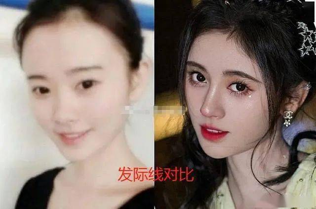 "四千年美女"鞠婧祎是连头皮都整了?看到她头发缝那一刻,惊呆了!