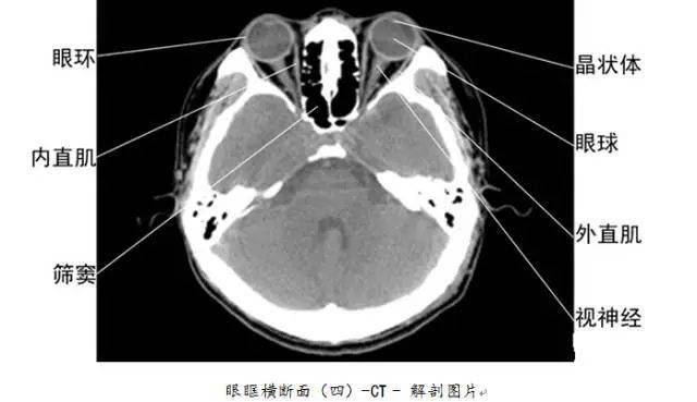 全身ct图谱,赶紧收藏了吧