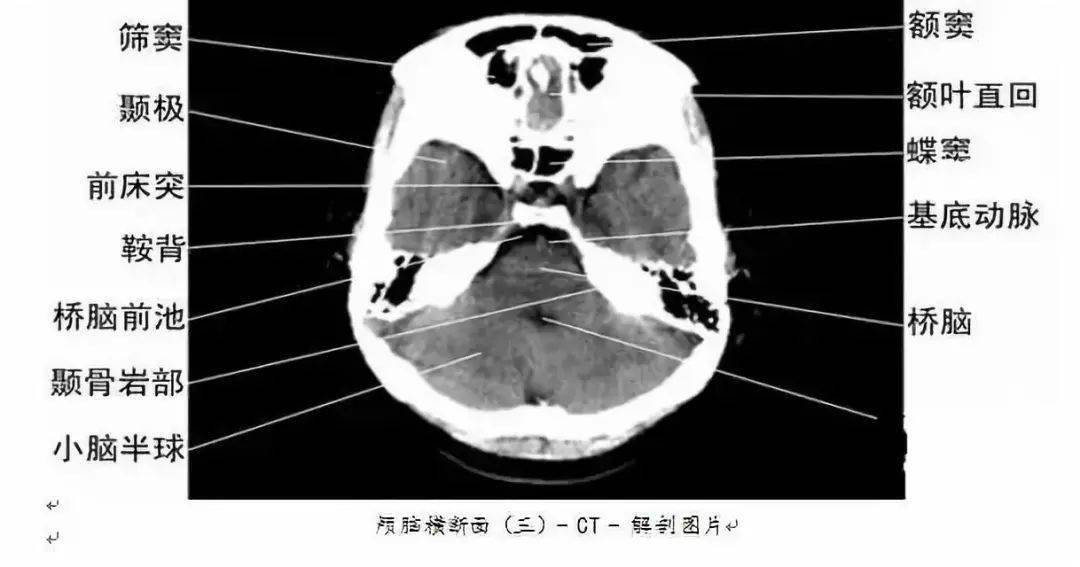 全身ct图谱,赶紧收藏了吧