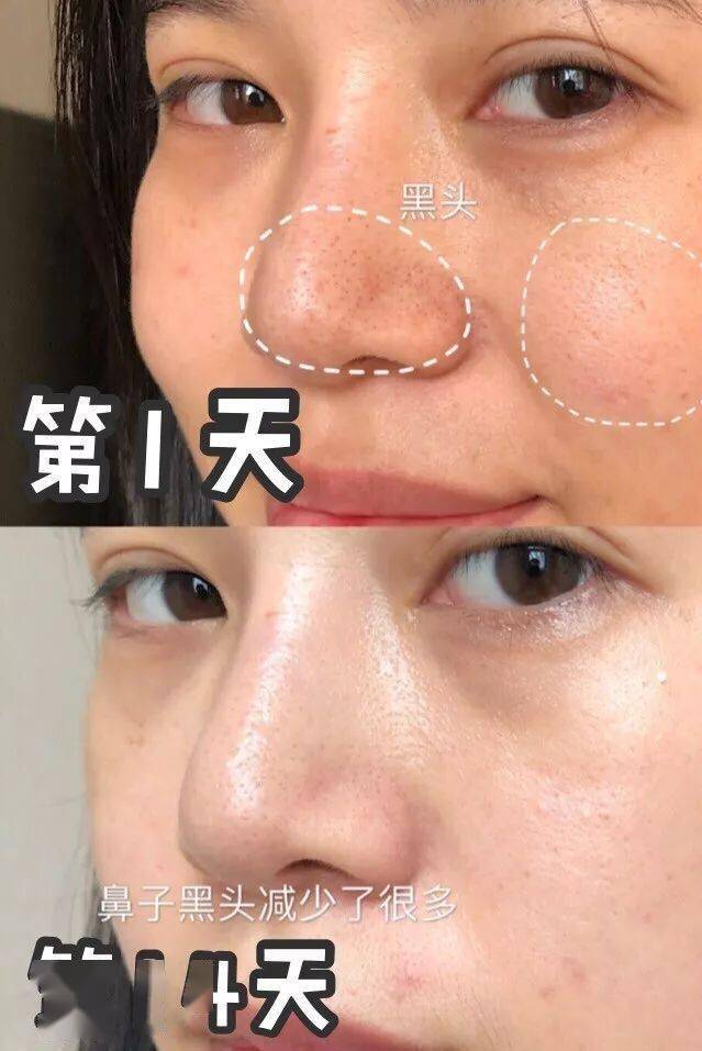 沈梦辰这脸变的!《乘风破浪》这皮肤状态,估计花了不少钱吧?